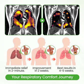 🇦🇺✅CareBreeze® Botanical Mullein Lung Cleanse Diffuser(🫁Cough, Pharyngitis, shortness of breath, sputum, stuffy nose, bronchitis, bronchitis, allergy symptoms, lung discomfort💝)