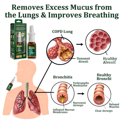 💖💖🇦🇺 Official Store:CareBreeze® 6-in-1 Herbal BeePropolis Lung Cleanse Spray🐝（👨‍⚕️Directly acts on COPD, asthma, chronic bronchitis (CB), respiratory infections, lung cancer, sinusitis, and other conditions）