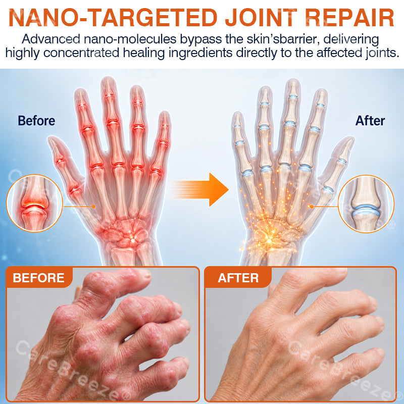 🦵✅🇦🇺 CareBreeze® Pain-Relief Bone-Healing Microneedle Patch(🧑‍⚕️Reducing joint swelling, pain, stiffness, redness, warmth, soreness, and joint fatigue)