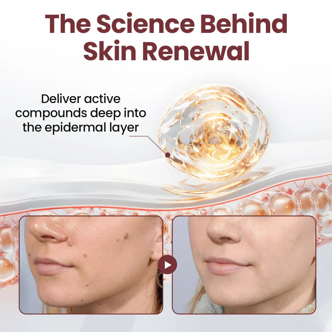 💗✅AU Owned and Operated：Pheromex®Dual-Action Plant Wart Removal Cream（👨‍⚕️Skin Tags,Acne,Hyperpigmentation,Eczema,Psoriasis,Rosacea,Warts)