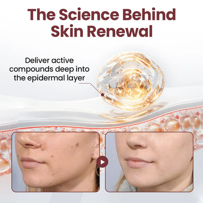 💗✅AU Owned and Operated：Pheromex®Dual-Action Plant Wart Removal Cream（👨‍⚕️Skin Tags,Acne,Hyperpigmentation,Eczema,Psoriasis,Rosacea,Warts)