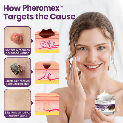 AU Owned and Operated：Pheromex®Dual-Action Plant Wart Removal Cream