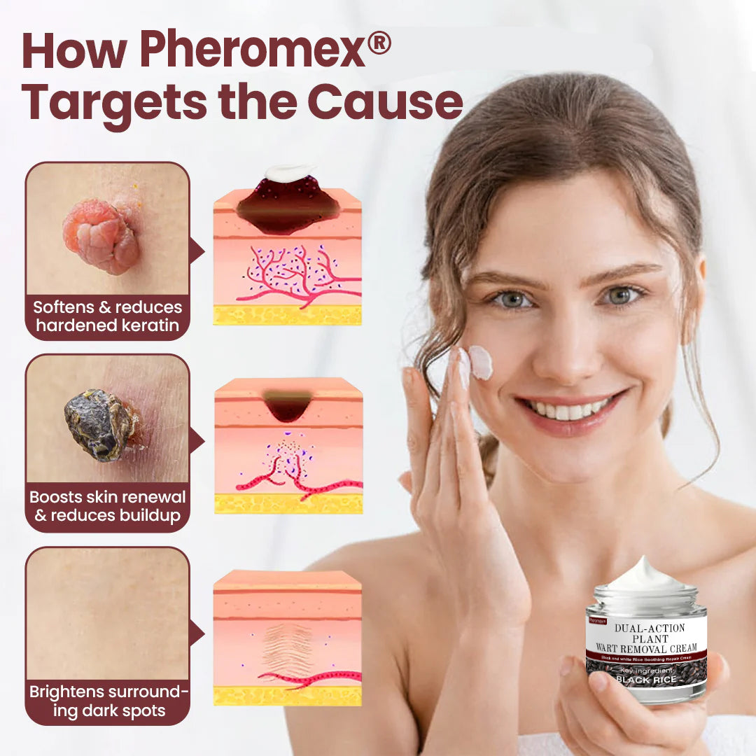 💗✅AU Owned and Operated：Pheromex®Dual-Action Plant Wart Removal Cream（👨‍⚕️Skin Tags,Acne,Hyperpigmentation,Eczema,Psoriasis,Rosacea,Warts)