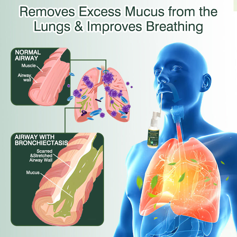 🛡️✅Official Store:CareBreeze® Botanical Mullein Leaf Extract Lung Cleanse Spray🫁（👨‍⚕️Directly acts on COPD, asthma, chronic bronchitis (CB), respiratory infections, lung cancer, sinusitis, and other conditions）