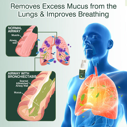 🛡️✅Official Store:CareBreeze® Botanical Mullein Leaf Extract Lung Cleanse Spray🫁（👨‍⚕️Directly acts on COPD, asthma, chronic bronchitis (CB), respiratory infections, lung cancer, sinusitis, and other conditions）