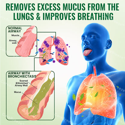 🇦🇺 ✅CareBreeze® Advanced Botanical Mullein Lung Cleanse Melt Strips（👨‍⚕️Directly acts on COPD, asthma, chronic bronchitis (CB), respiratory infections, lung cancer, sinusitis, and other conditions）