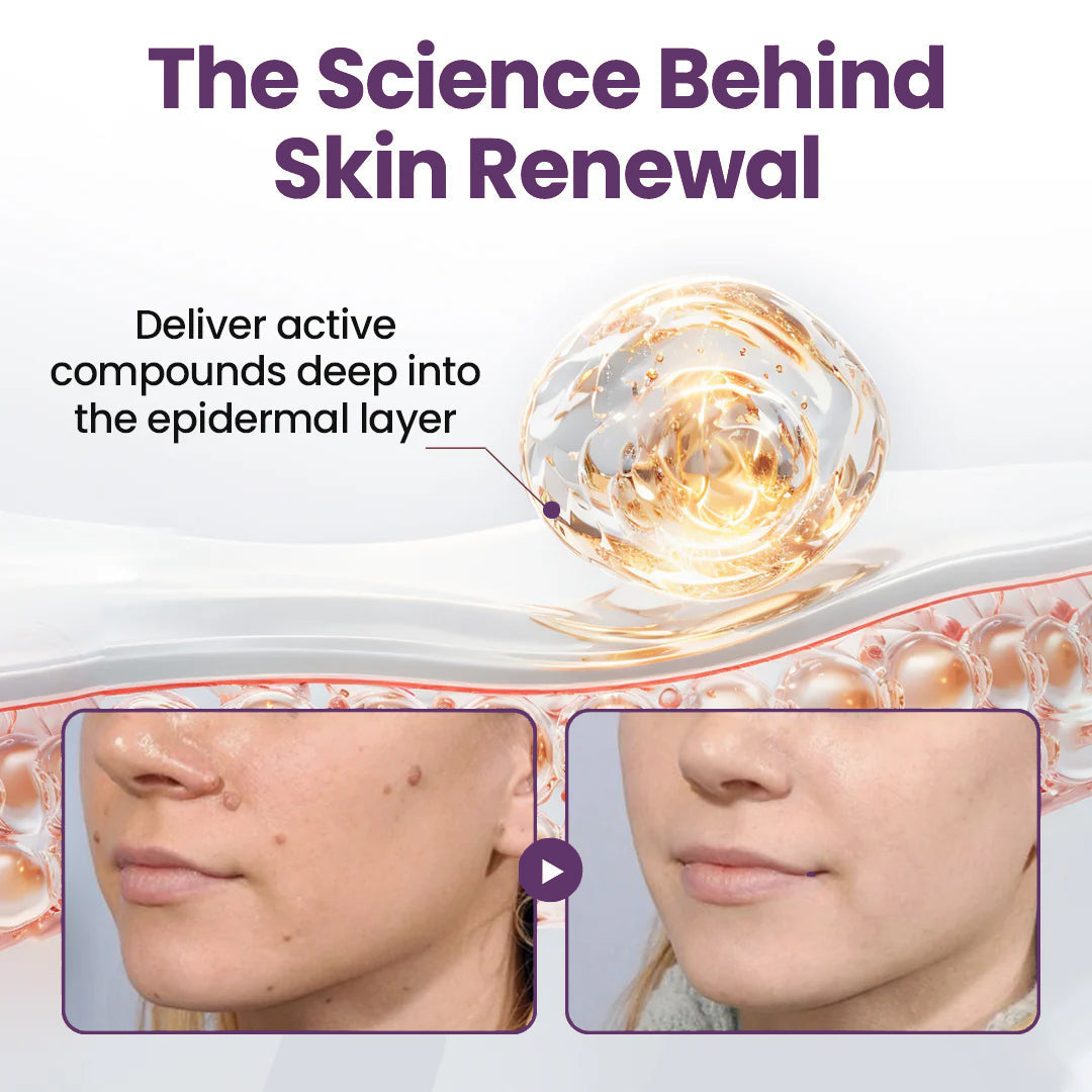 AU Owned and Operated：Pheromex®Dual-Action Plant Wart Removal Cream