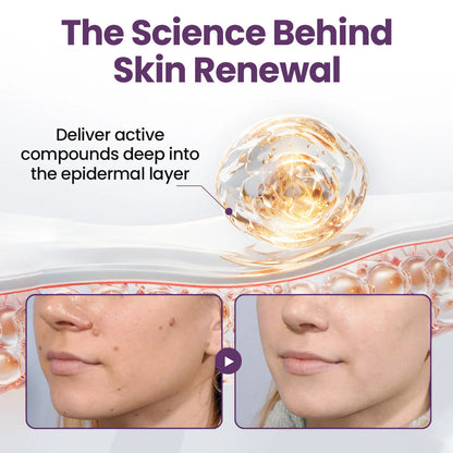 AU Owned and Operated：Pheromex®Dual-Action Plant Wart Removal Cream
