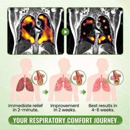 🇦🇺 ✅CareBreeze® Advanced Botanical Mullein Lung Cleanse Melt Strips（👨‍⚕️Directly acts on COPD, asthma, chronic bronchitis (CB), respiratory infections, lung cancer, sinusitis, and other conditions）