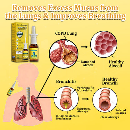 🐝AU Official Store:CareBreeze® 6-in-1 Herbal BeePropolis Lung Cleanse Spray（👨‍⚕️Directly acts on COPD, asthma, chronic bronchitis (CB), respiratory infections, lung cancer, sinusitis, and other conditions）